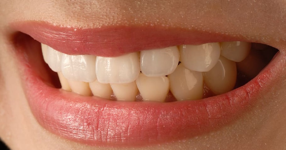 Wybielanie zębów domowymi sposobami. Podpowiadamy, których z nich lepiej unikać
