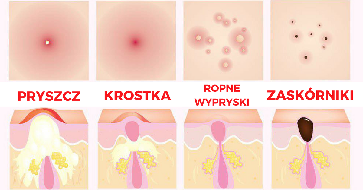 Sekretne triki na oczyszczanie skóry, których uczą na profesjonalnych kursach kosmetycznych!