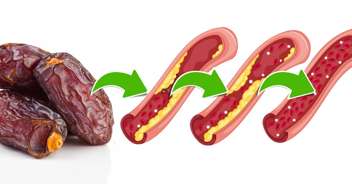 Niepozorne daktyle zapobiegają atakom serca, nadciśnieniu i udarowi. Lekarz Ci tego nie powie