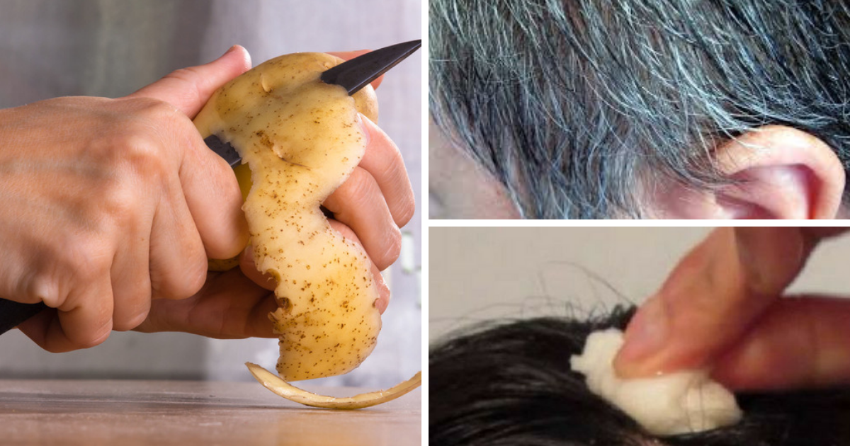 Potrzebujesz jedynie ziemniaka, by pożegnać się z siwizną