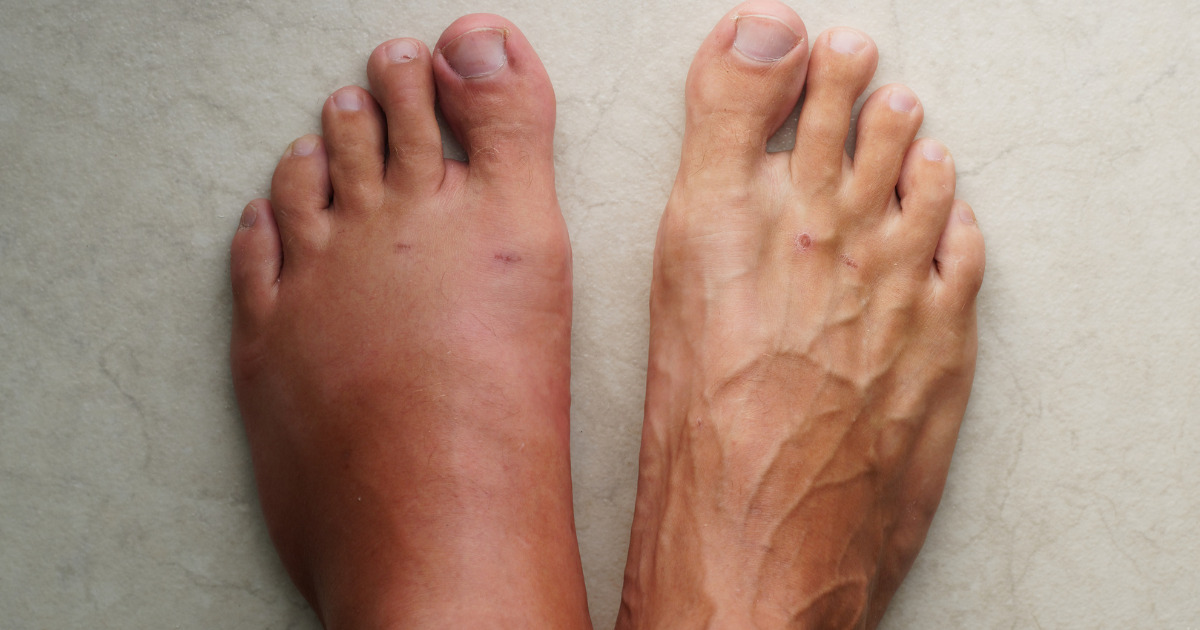 10 przykładów, jak pogoda wpływa na nasze ciało i samopoczucie. Aż trudno w to uwierzyć