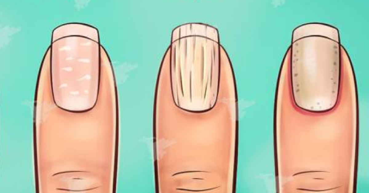 Paznokcie zdradzają wiele sekretów o Twoim zdrowiu. Znajdź swój kształt i się o tym przekonaj