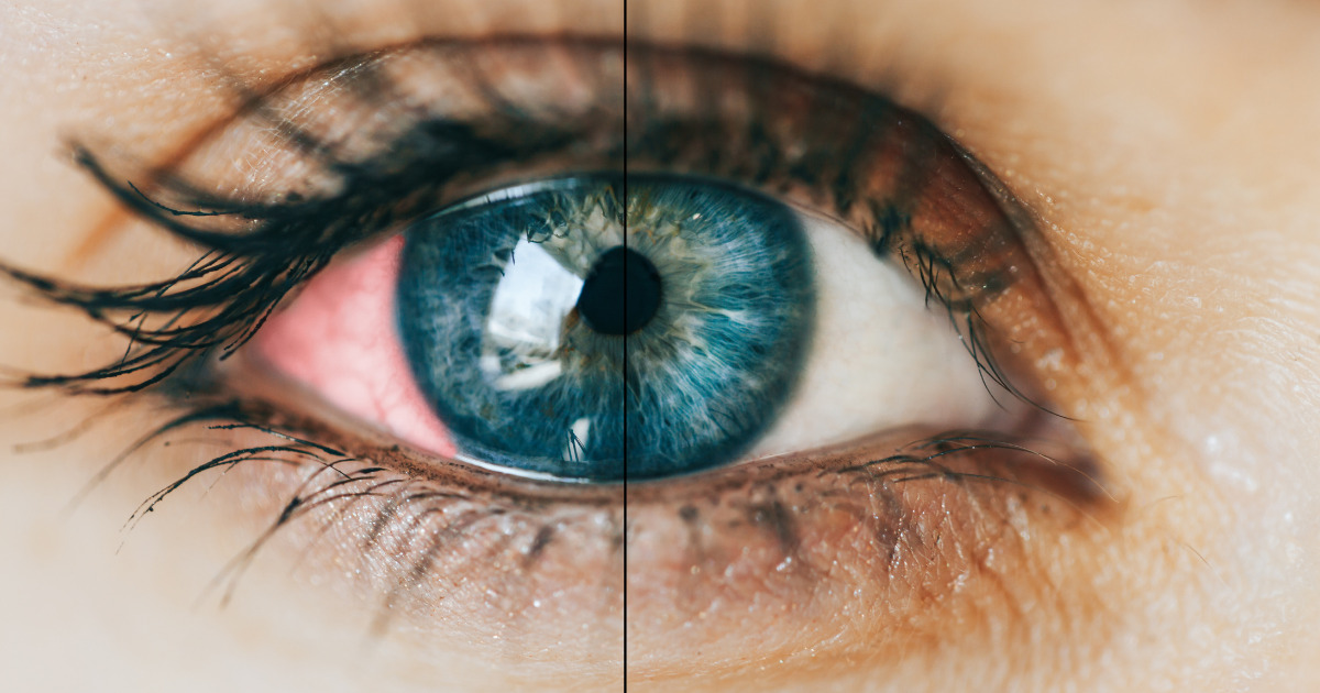 Ryzyko udaru i zawału możesz wyczytać z oczu. Ta wiedza może uratować życie