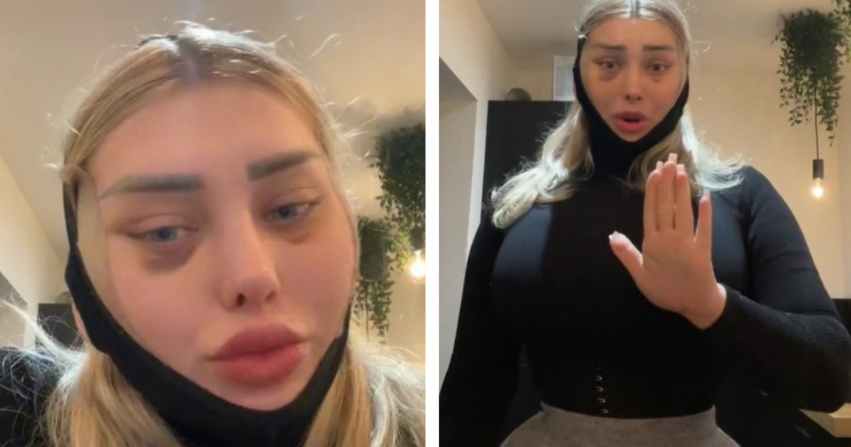 Wracała samolotem po operacji plastycznej, gdy nagle "tył mojej głowy eksplodował"