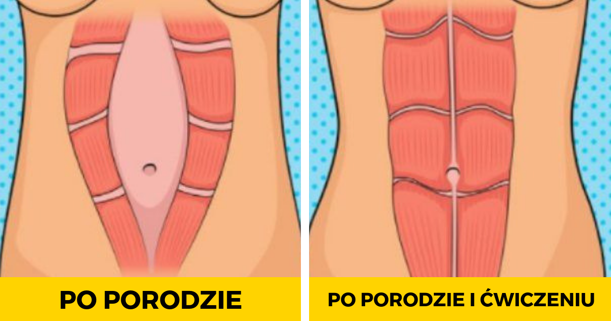 1 ćwiczenie na odzyskanie talii po porodzie. 100 % skuteczności