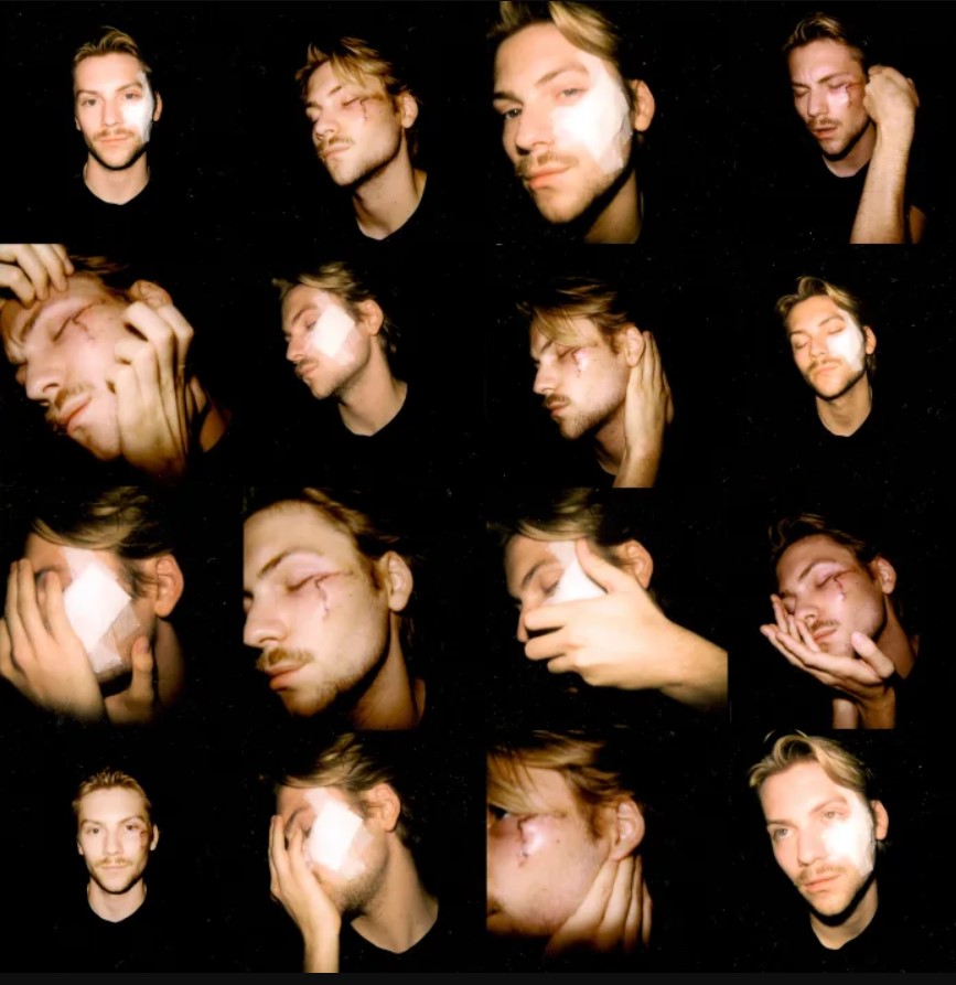 Kariera pływacka doprowadziła go do poważnej choroby. Wszystko uwiecznił na fotografiach