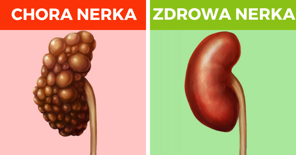 6 popularnych nawyków, które mogą uszkodzić nerki