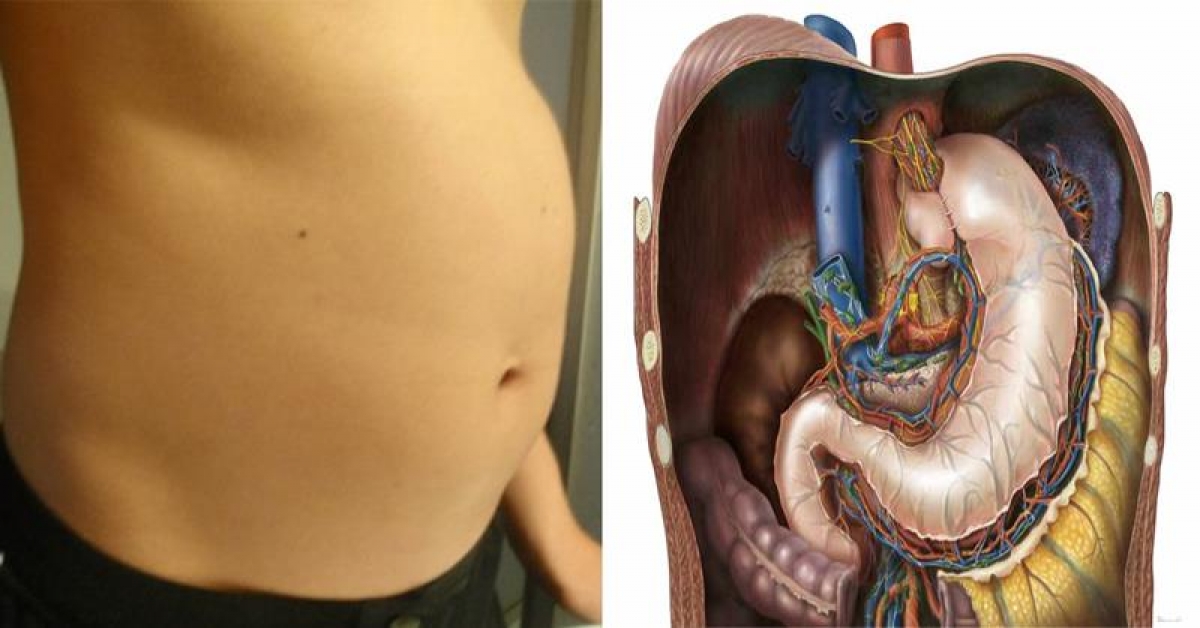 8 niepokojących powodów, przez które czujesz się pełny i ociężały przez cały czas