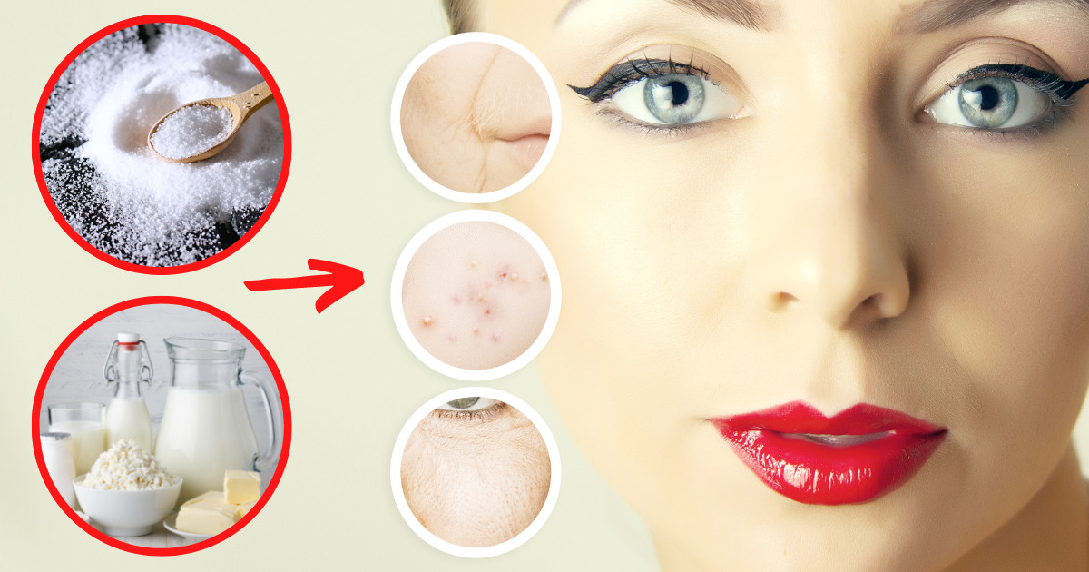 6 produktów spożywczych, które niszczą Twoją cerę. Wyklucz je z diety i zapomnij o problemie
