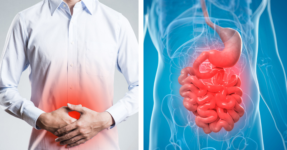 Rozpoznaj przyczynę bólu brzucha po jego lokalizacji i rodzaju. Ta wiedza może Ci się przydać