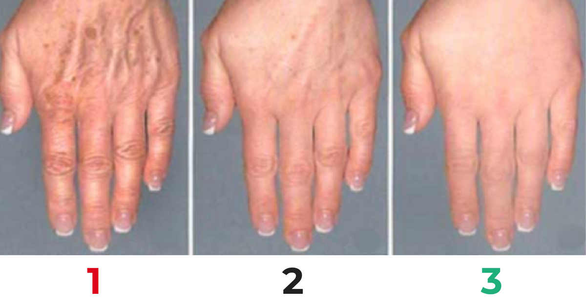 Proste metody na powstrzymanie starzenia się dłoni. Będą wyglądać jak dawniej!