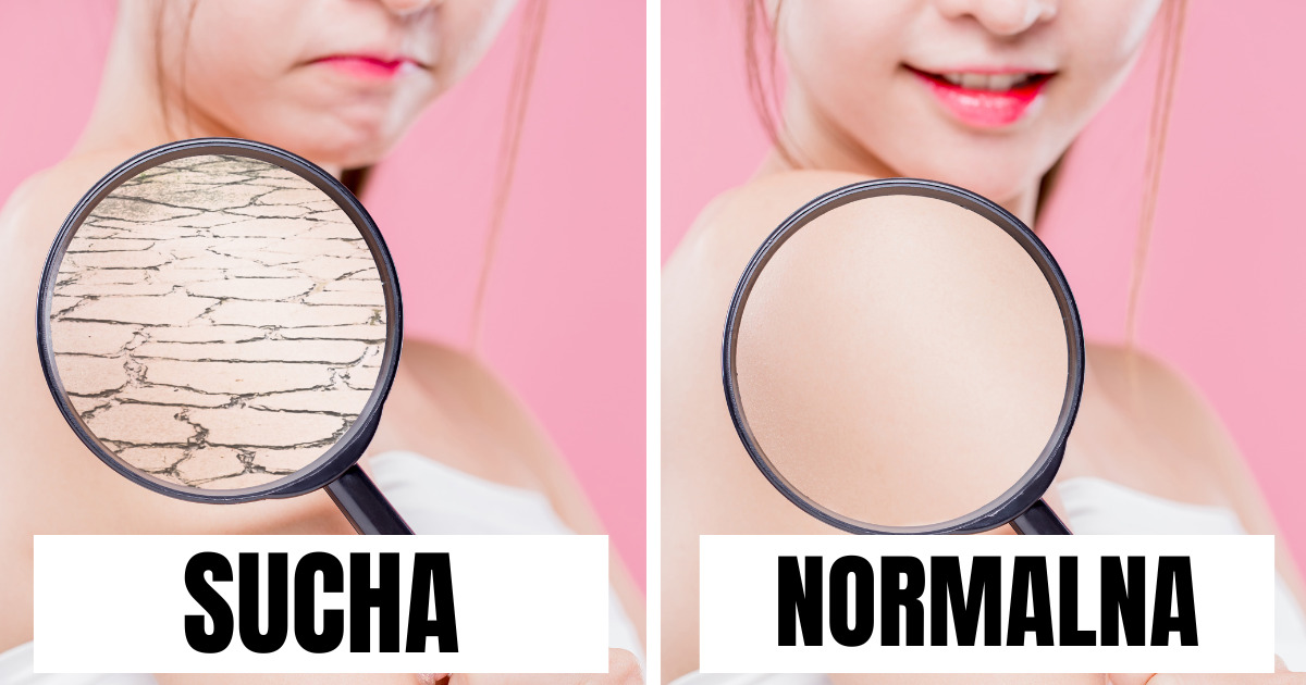 Oto jak należy dbać o cerę w zależności od jej typu. Każdy z nich wymaga innego podejścia