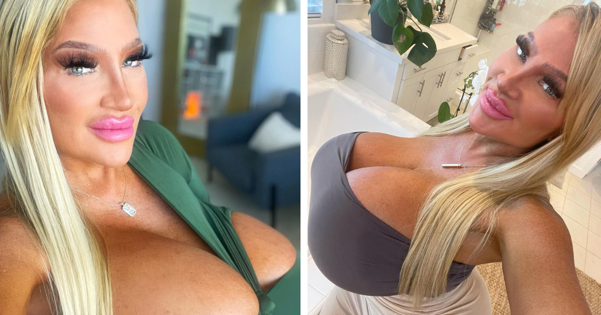 Fanka operacji plastycznych pokazała jak wyglądała 20 lat wcześniej. Aż ciężko w to uwierzyć!