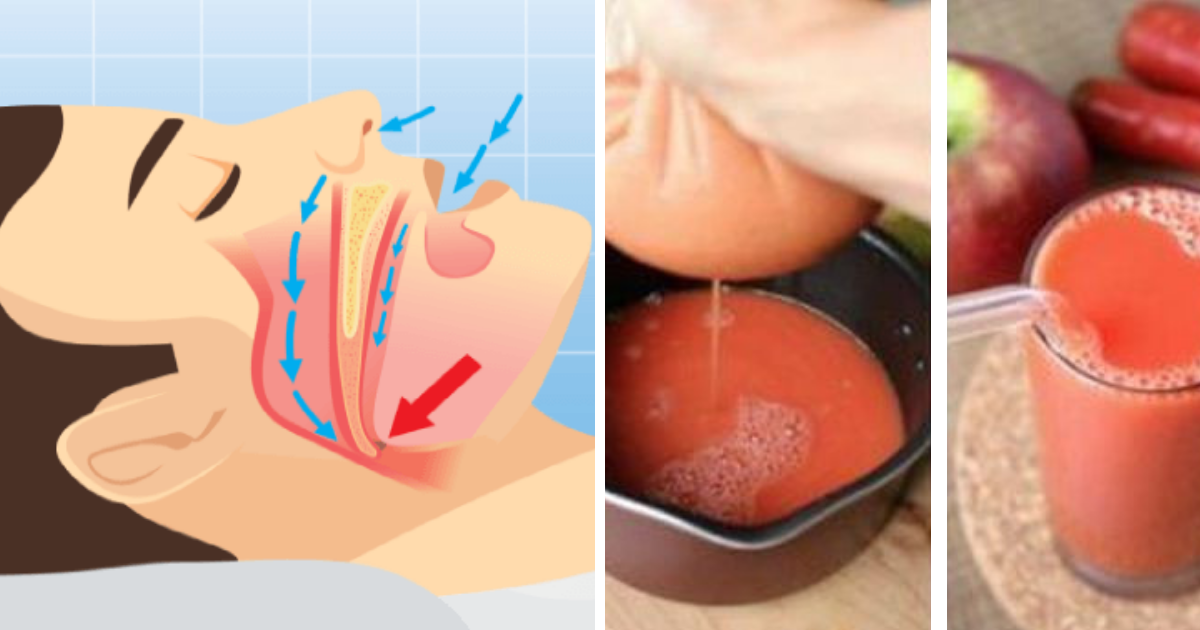 Naturalne rozwiązanie, które zatrzyma uciążliwe chrapanie i niebezpieczny bezdech senny